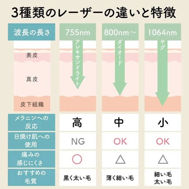 医療脱毛 レーザーの違いと特徴