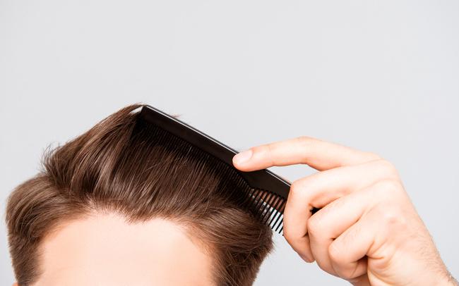 季節的に起こりやすい抜け毛の予防方法とは